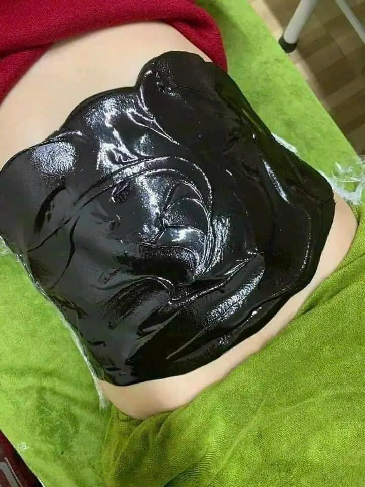 Tan mỡ 