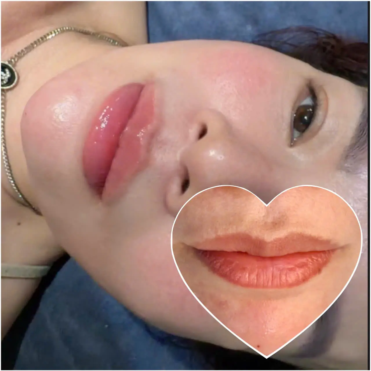 Làm hồng môi 